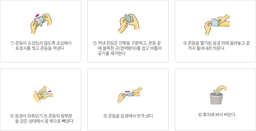 1. 콘돔이 손상되지 않도록 조심해서 포장지를 찢고 콘돔을 꺼낸다. 2. 꺼낸 콘돔은 안팎을 구분하고, 콘돔 끝에 볼록한 곳(정액받이)를 잡고 비틀어 공기를 제거한다. 3.콘돔을 발기된 음경 위에 올려놓고 끝까지 풀어내려 씌운다. 4. 음경이 위축되기 전 콘돔의 링부분을 잡은 상태에서 몸 밖으로 빼낸다. 5. 콘돔을 음경에서 벗겨 낸다. 6.휴지에 싸서 버린다.